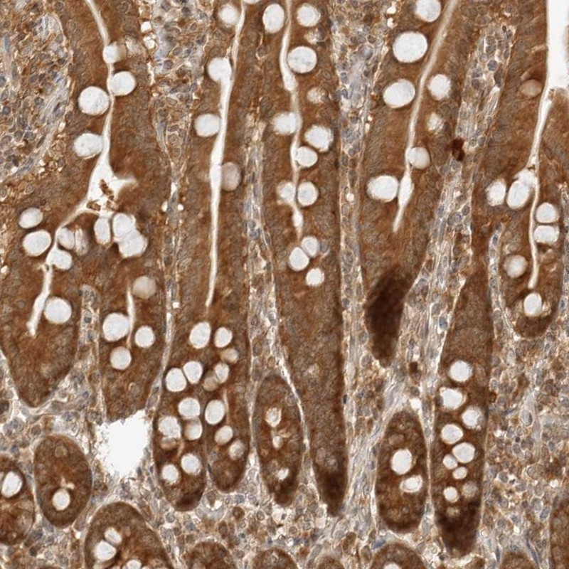 Atlas Antibodies Anti-PRRC2C Antibody