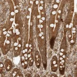 Atlas Antibodies Anti-PRRC2C Antibody