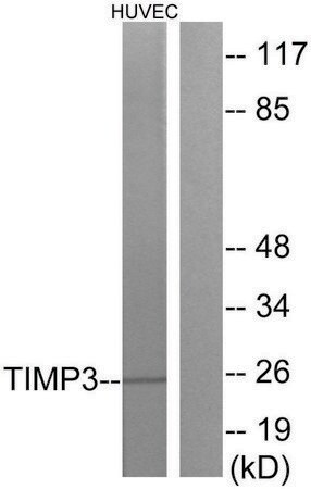 Merck Anti-TIMP3 antibody produced in rabbit