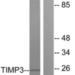 Merck Anti-TIMP3 antibody produced in rabbit
