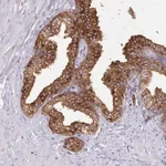 Merck Anti-SRD5A1 antibody produced in rabbit