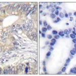 Merck ANTI-SOMATOSTATIN ANTIBODY PRODUCED IN R