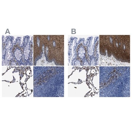 Merck Anti-ANXA1 antibody produced in rabbit