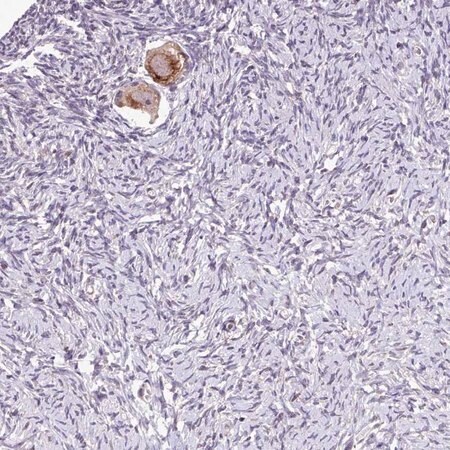 Merck Anti-TTLL3 antibody produced in rabbit