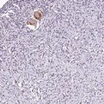 Merck Anti-TTLL3 antibody produced in rabbit