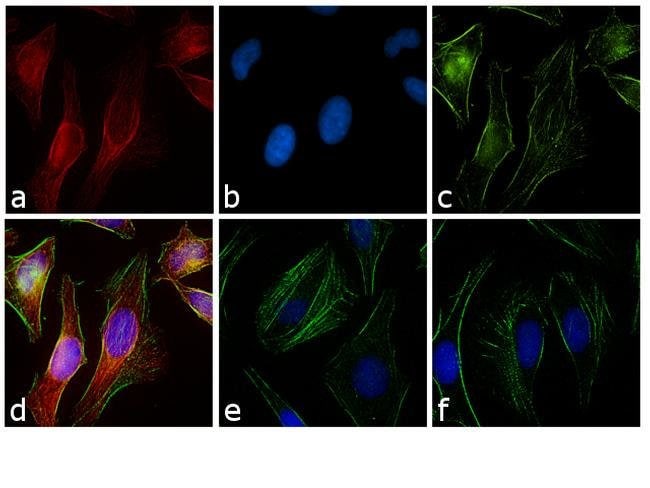 Thermo Fisher Scientific Goat anti-Rabbit IgG (H+L) Cross-Adsorbed Secondary Antibody, Rhodamine