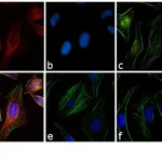 Thermo Fisher Scientific Goat anti-Rabbit IgG (H+L) Cross-Adsorbed Secondary Antibody, Rhodamine