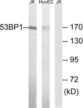Merck Anti-53BP1 antibody produced in rabbit