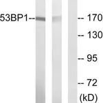 Merck Anti-53BP1 antibody produced in rabbit