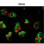 Merck Anti-TRPV6