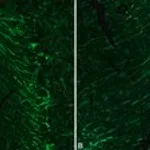 Merck MOUSE MONOCLONAL ANTI-NEUROFILAMENT 200&