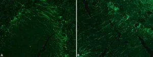 Merck MOUSE MONOCLONAL ANTI-NEUROFILAMENT 200&