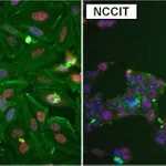 Thermo Fisher Scientific Goat anti-Rabbit IgG (H+L) Secondary Antibody, DyLight 594