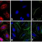 Thermo Fisher Scientific Donkey anti-Mouse IgG (H+L) Cross-Adsorbed Secondary Antibody, DyLight 594