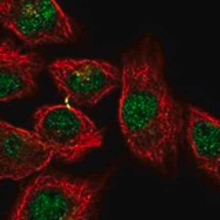 Merck Anti-KCTD1 antibody produced in rabbit