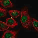 Merck Anti-KCTD1 antibody produced in rabbit