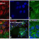 Thermo Fisher Scientific Donkey anti-Rabbit IgG (H+L) Highly Cross-Adsorbed Secondary Antibody, Alexa Fluor Plus 594