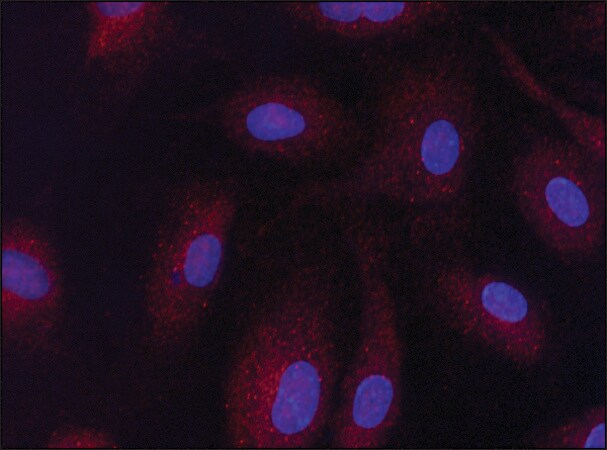Merck Anti-Sirt3 antibody produced in rabbit
