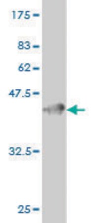 Merck Monoclonal Anti-GUCY2C antibody produced in mouse