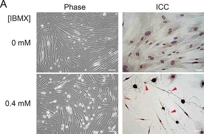 Merck Anti-Neuron-Specific Enolase (NSE), Mouse monoclonal