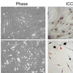 Merck Anti-Neuron-Specific Enolase (NSE), Mouse monoclonal