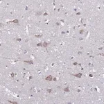 Merck Anti-TMEM8C antibody produced in rabbit