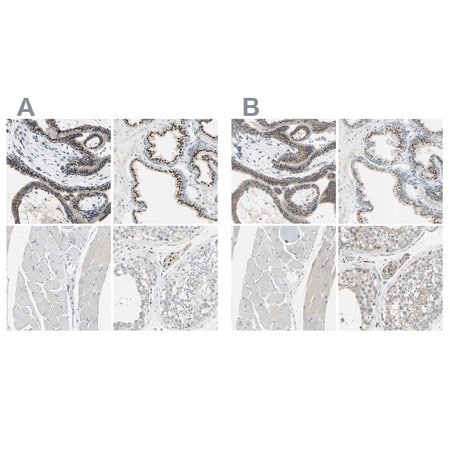 Merck Anti-B4GALT1 antibody produced in rabbit