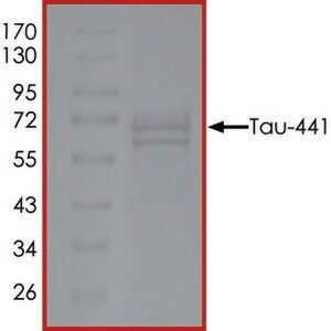 Merck TAU-441, GSK3BETA-PHOSPHORYLATED