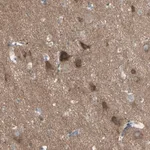 Merck Anti-PCDHGA2 antibody produced in rabbit