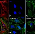 Thermo Fisher Scientific Goat anti-Mouse IgG (H+L) Highly Cross-Adsorbed Secondary Antibody, Alexa Fluor 555