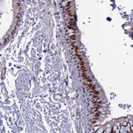 Atlas Antibodies Anti-CLK4 Antibody
