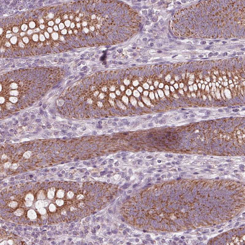 Atlas Antibodies Anti-CLN6 Antibody