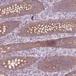 Atlas Antibodies Anti-CLN6 Antibody