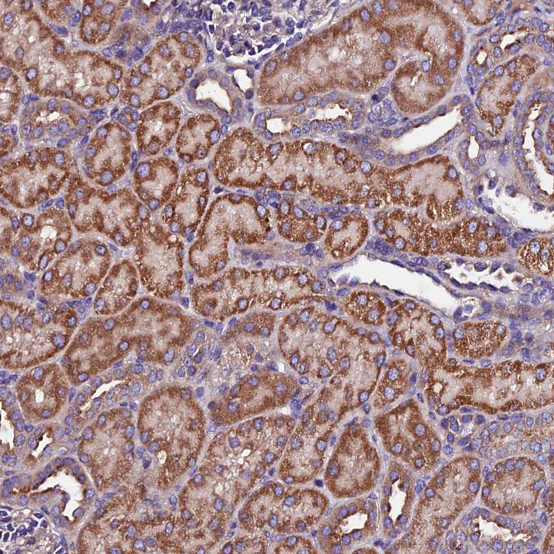 Atlas Antibodies Anti-CLN5 Antibody