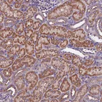 Atlas Antibodies Anti-CLN5 Antibody