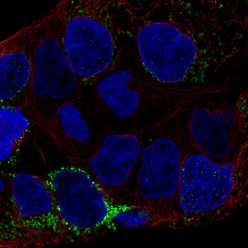 Atlas Antibodies Anti-CLN6 Antibody