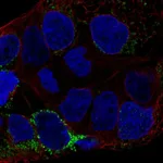 Atlas Antibodies Anti-CLN6 Antibody
