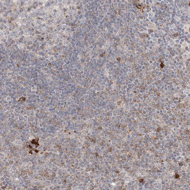 Atlas Antibodies Anti-CLNK Antibody