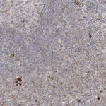 Atlas Antibodies Anti-CLNK Antibody