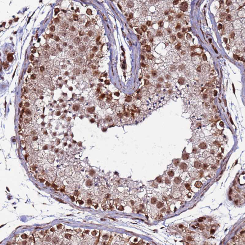 Atlas Antibodies Anti-CLK3 Antibody