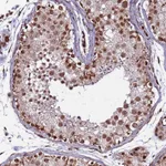 Atlas Antibodies Anti-CLK3 Antibody