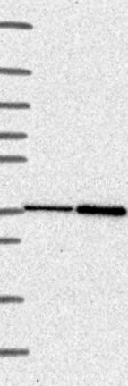 Atlas Antibodies Anti-CLN6 Antibody
