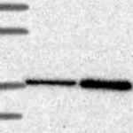 Atlas Antibodies Anti-CLN6 Antibody