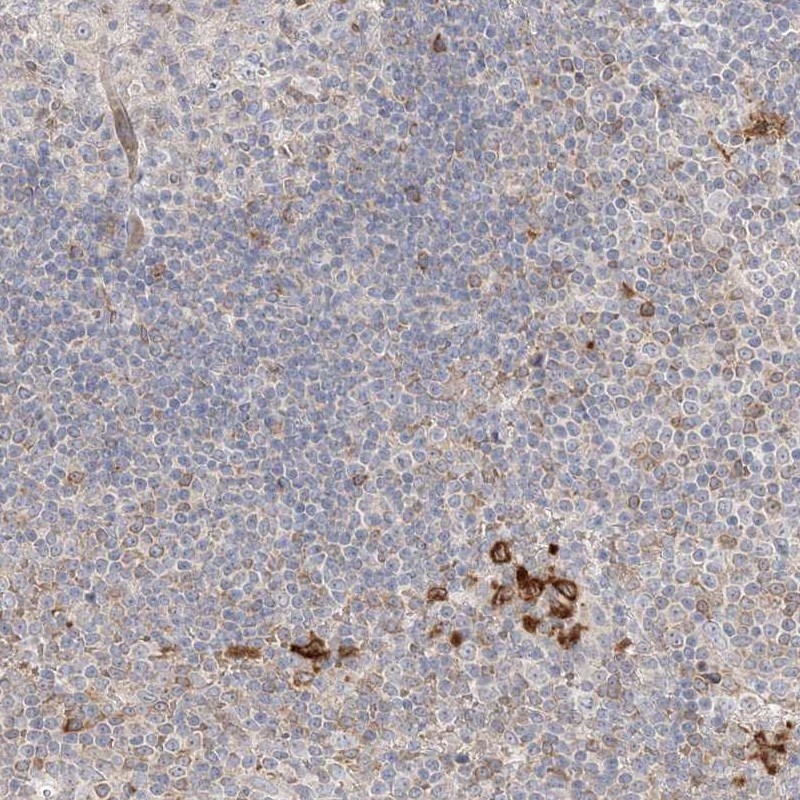 Atlas Antibodies Anti-CLNK Antibody