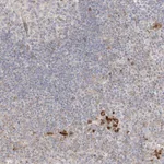 Atlas Antibodies Anti-CLNK Antibody