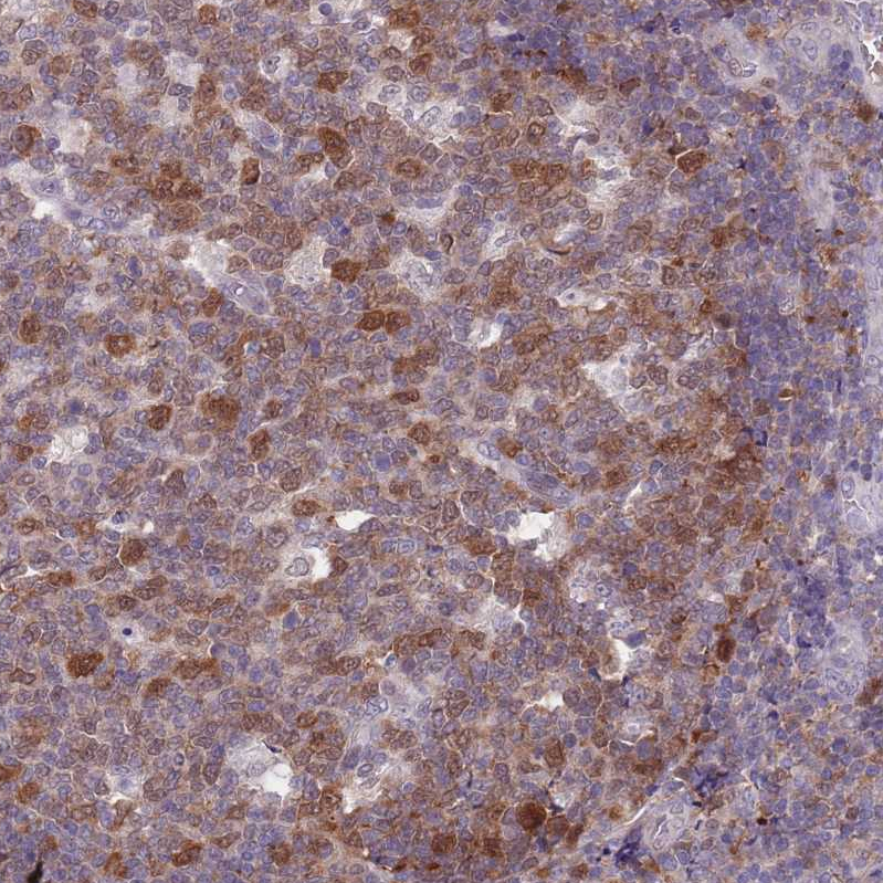 Atlas Antibodies Anti-CLNS1A Antibody