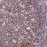 Atlas Antibodies Anti-CLNS1A Antibody