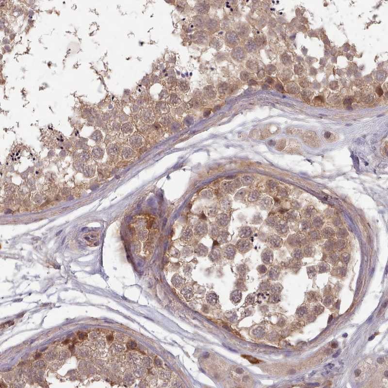 Atlas Antibodies Anti-CLNS1A Antibody