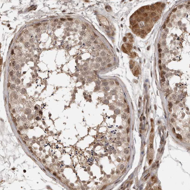 Atlas Antibodies Anti-CLOCK Antibody