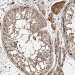Atlas Antibodies Anti-CLOCK Antibody